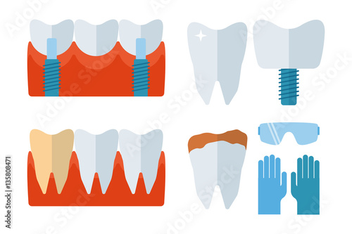 Dentist tooth implants and stomatology equipment vector illustration.