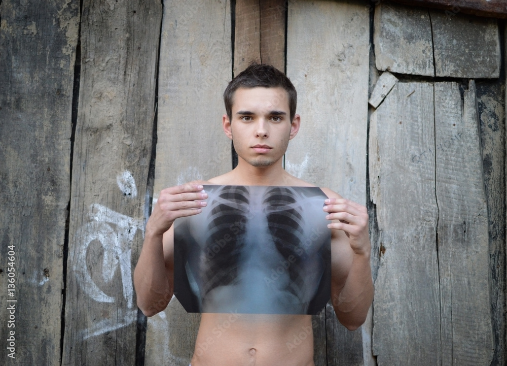 Young handsome guy holding an x-ray in front of his torso. Man shows an X-ray warning about the dangers of smoking and alcohol on a wooden background old.