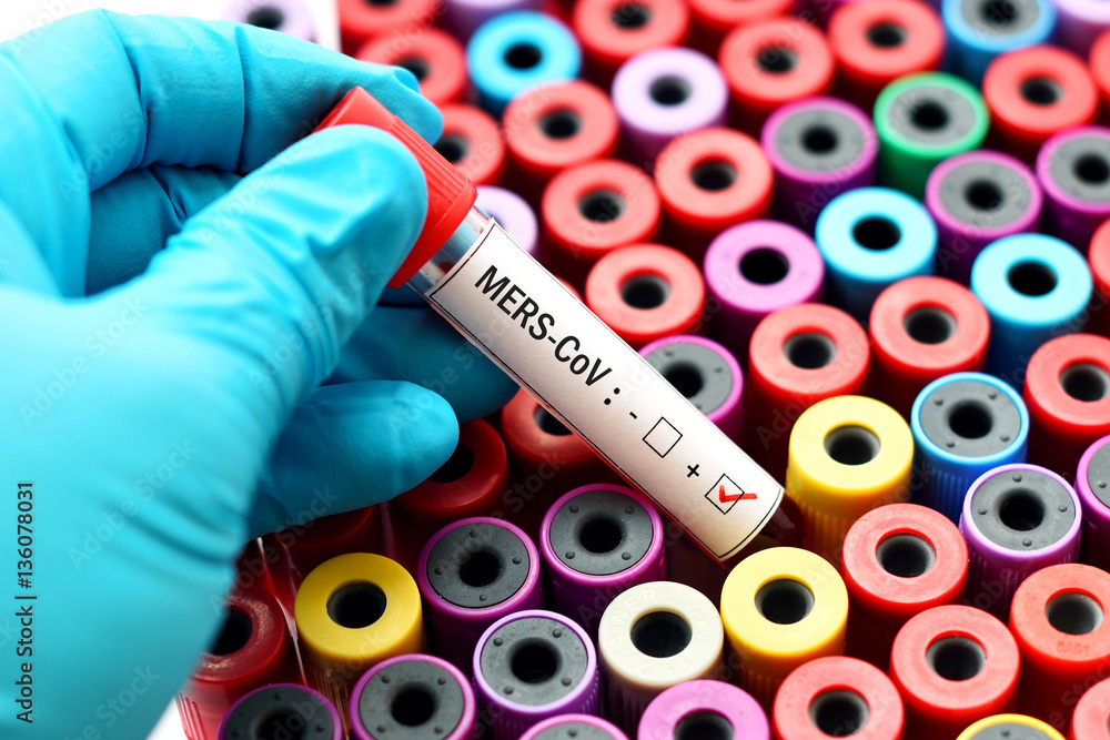 Fototapeta premium MERS-CoV positive