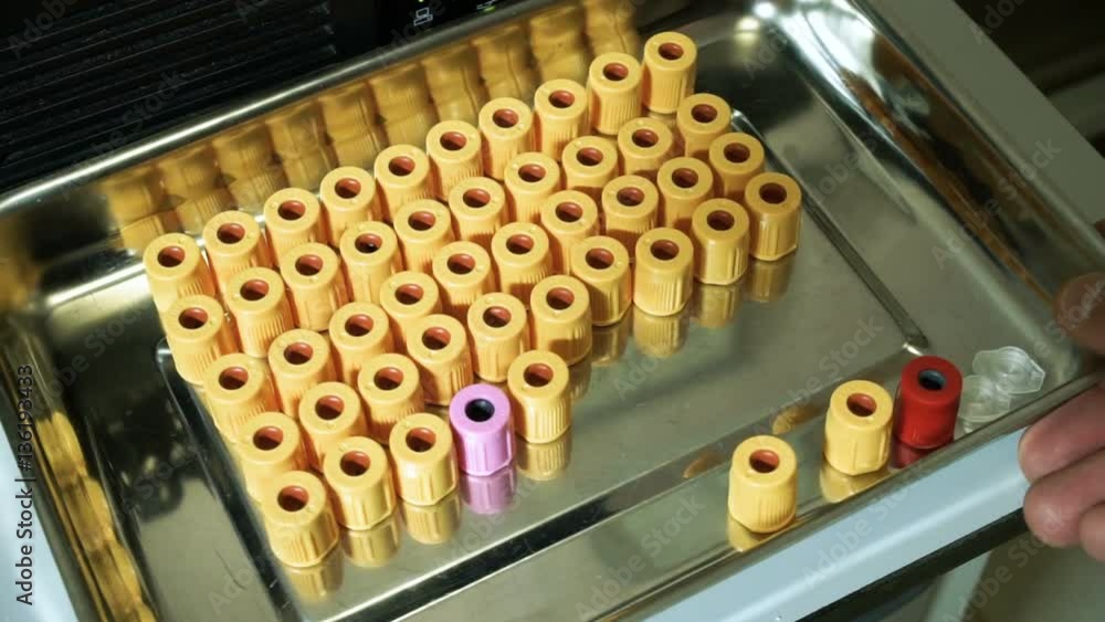 Laboratory analysing of blood. Close-up shot of rubber caps for glass retorts on a metal tray. HD Laboratory analysing of blood. Close-up shot of rubber caps for glass retorts on a metal tray. HD