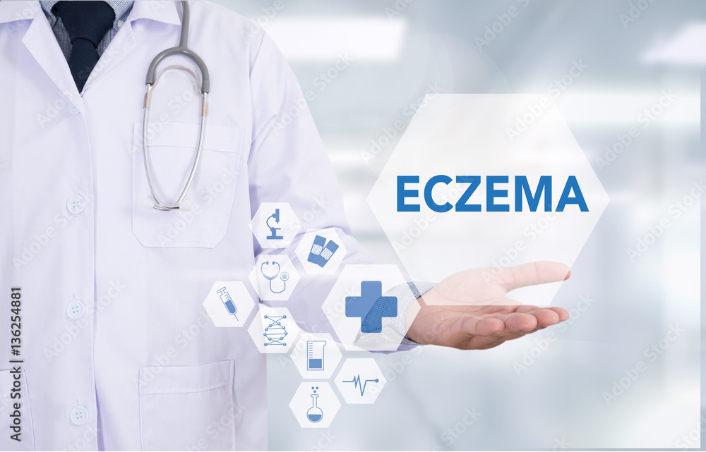 ECZEMA dermatitis eczema skin of patient , The problem with many ECZEMA dermatitis eczema skin of patient , The problem with many