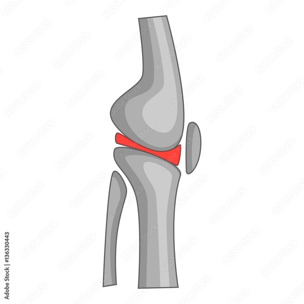 Total knee replacement surgery icon, cartoon style