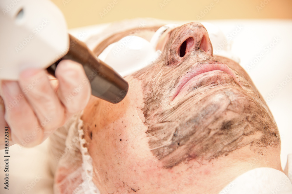 Naklejka premium laser treatment / carbon laser treatment skin