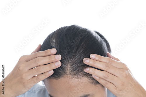 Young woman shows her gray hair roots