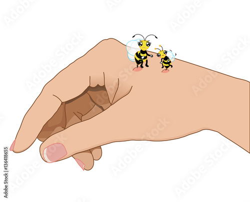 Bee sting on hand cartoon illustration