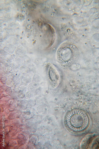 Gills of fish ,protozoa and Trichodina spp. under the microscope.(soft focus and have Grain/Noise ) photo