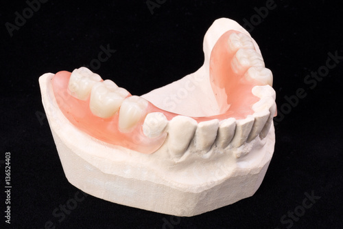 Tableau sur toile Denture, lower jaw