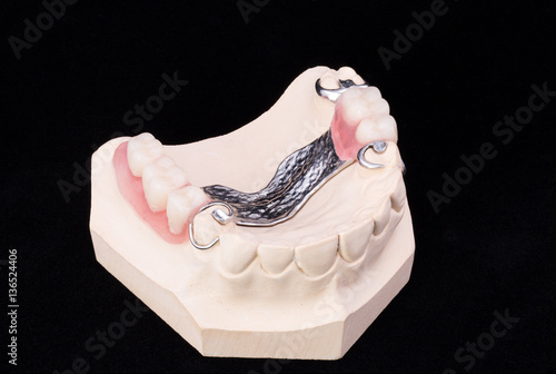 Denture, lower jaw