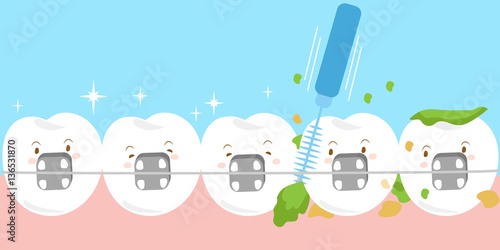  tooth wear brace with brush
