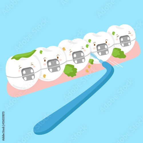  tooth wear brace with brush