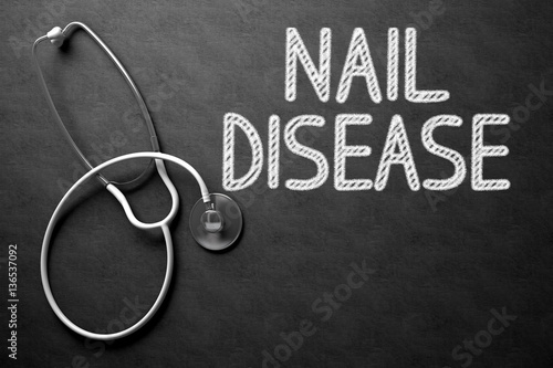 Chalkboard with Nail Disease Concept. 3D Illustration. photo