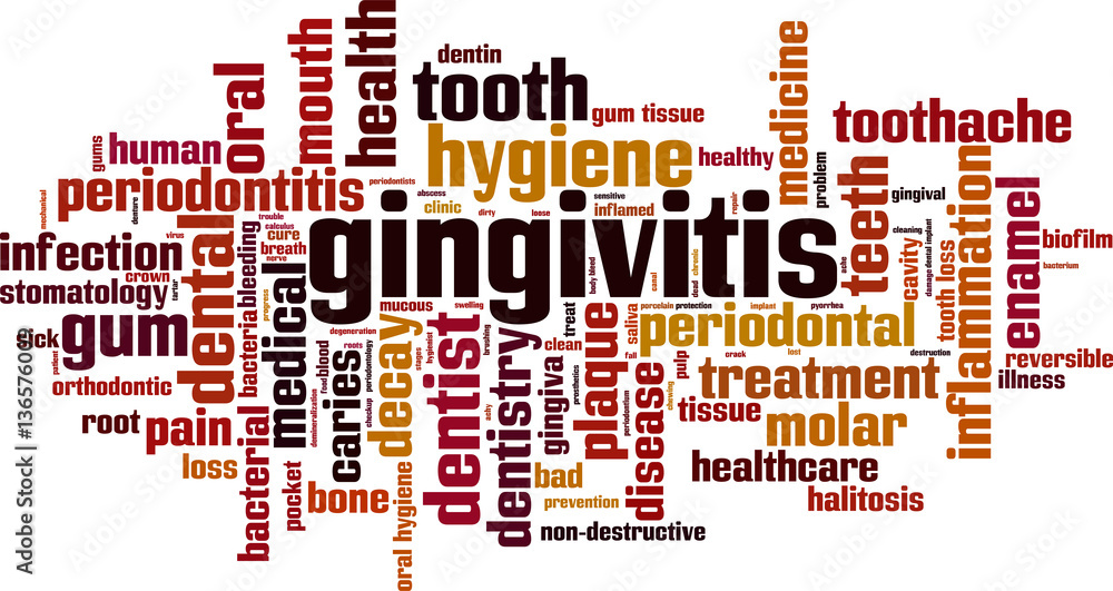 Gingivitis word cloud concept. Vector illustration Gingivitis word cloud concept. Vector illustration