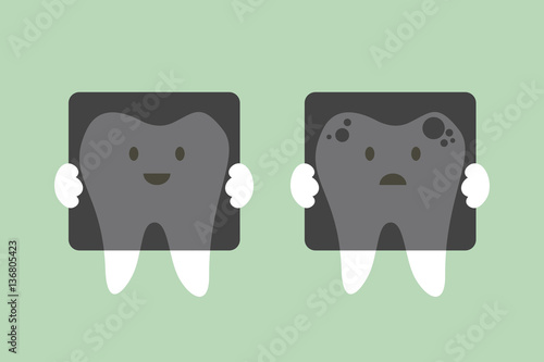 tooth holding dental x-ray film