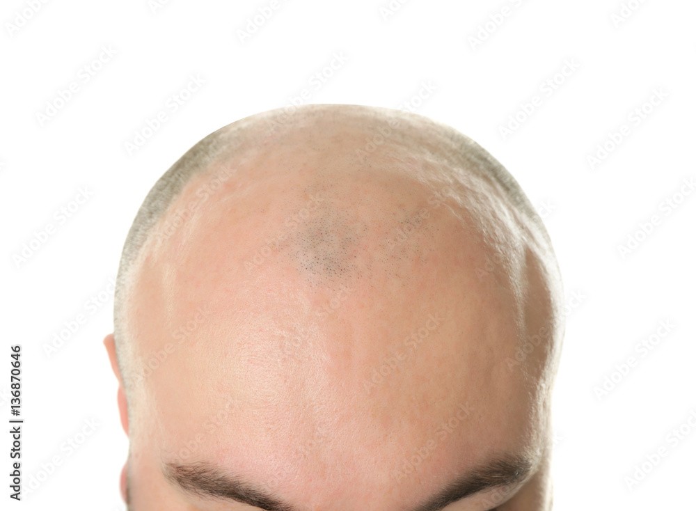 Fototapeta premium Bald adult man on white background, closeup