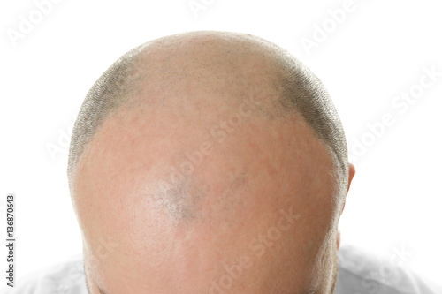 Bald adult man on white background, closeup