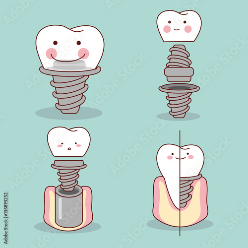 cute cartoon tooth implant
