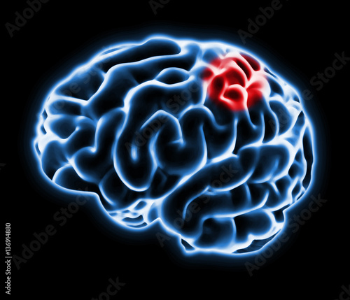 brain pain illustration