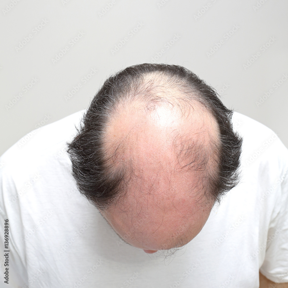Obraz premium Bald
