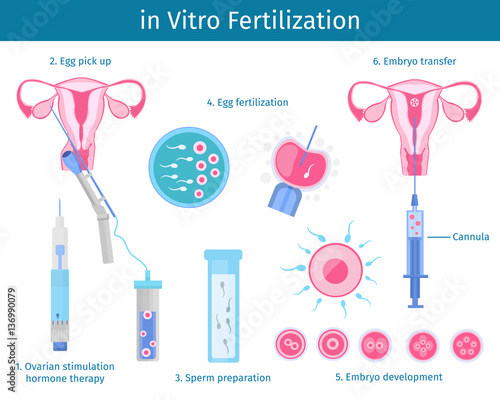 In Vitro Fertilization Process Concept