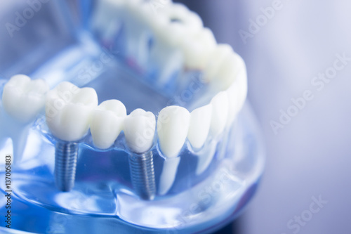 Dental teeth dentistry model photo