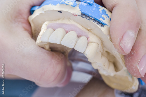 Dental technician working in a metal ceramic crowns