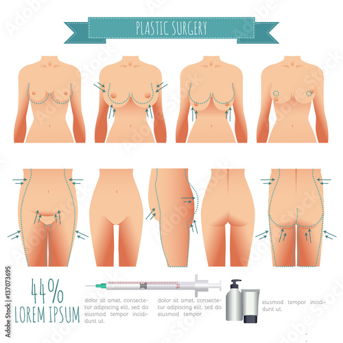 Plastic surgery illustrations. breast lift, lipofilling, abdominoplasty