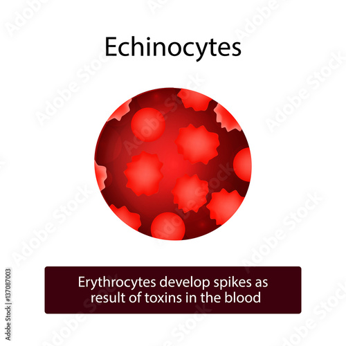Echinocytes. Erythrocytes develop spikes as result of toxins in the blood. Vector illustration on isolated background
