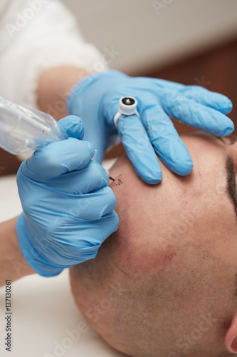 professional tattooist making permanent make up tricopigmentation