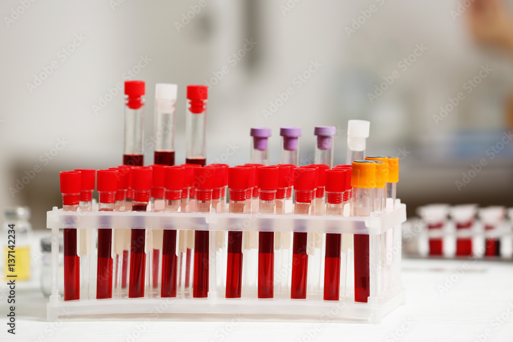 Test tubes with blood samples on table in laboratory Test tubes with blood samples on table in laboratory