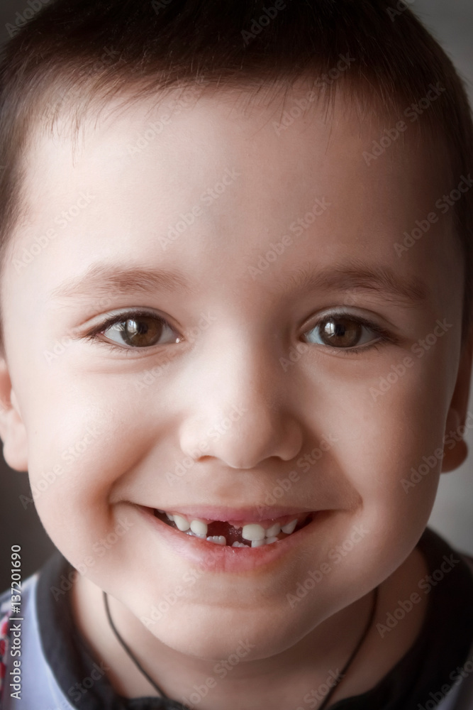 Young boy smiling, showing off his first missing milk tooth. Portrait little boy closeup Young boy smiling, showing off his first missing milk tooth. Portrait little boy closeup