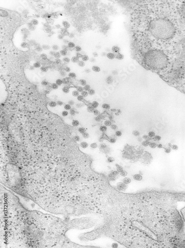 Negatively-stained transmission electron micrograph of Rubella virus virions budding from the host cell surface to be freed into the host’s system, producing an enveloped virus particle