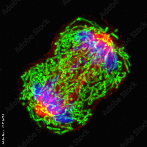 Microscopic image breast cancer cell dividing photo