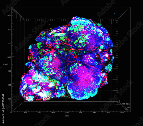 Transparent tumor tomography visualising tumor microenvironment, showing a mouse model for HER2-positive breast cancer with hypoxic areas of cancer cells in green photo