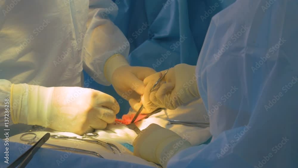 Hands wearing surgical gloves performing surgery. Close up. 4K. Hands wearing surgical gloves performing surgery. Close up. 4K.