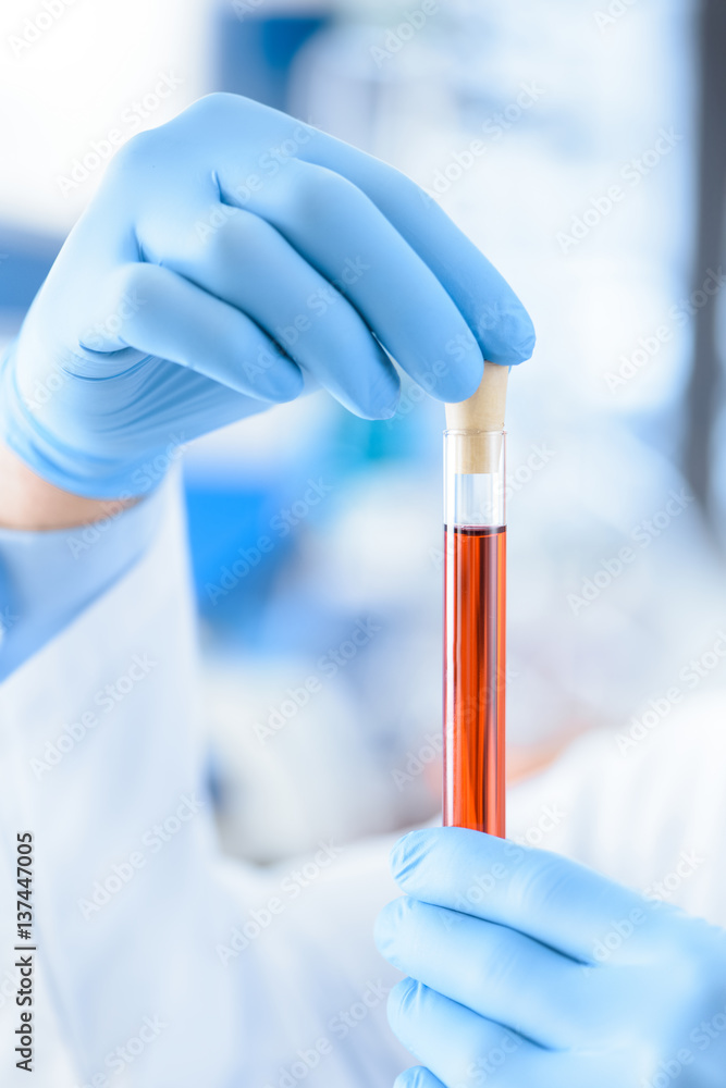 Close-up partial view of scientist in protective gloves holding test tube with reagent Close-up partial view of scientist in protective gloves holding test tube with reagent