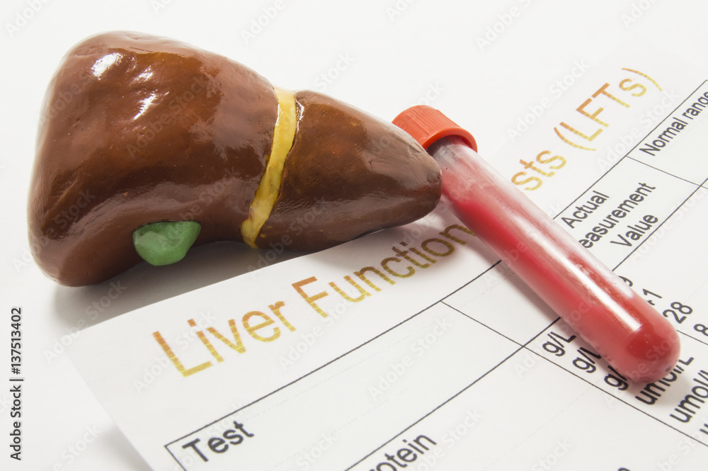 Figure of human liver, laboratory test tube or bottle with blood and paper result of liver function or enzyme test (LFTs) analysis are on doctor table. Concept to represent liver function test or exam Figure of human liver, laboratory test tube or bottle with blood and paper result of liver function or enzyme test (LFTs) analysis are on doctor table. Concept to represent liver function test or exam