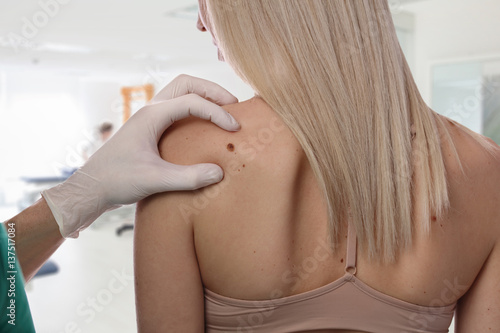 Doctor dermatologist examines birthmark of patient close up isolated on white background. Checking benign moles. Laser Skin tags removal