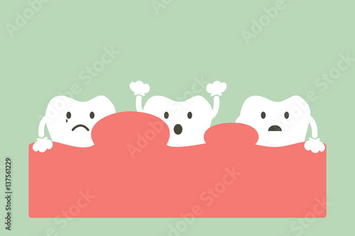 gingivitis