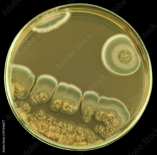 Colonies of of allergic mould from air spores and/or biologically damaged constructions on a petri dish (agar plate) manually isolated on a black background. Focus on full depth.