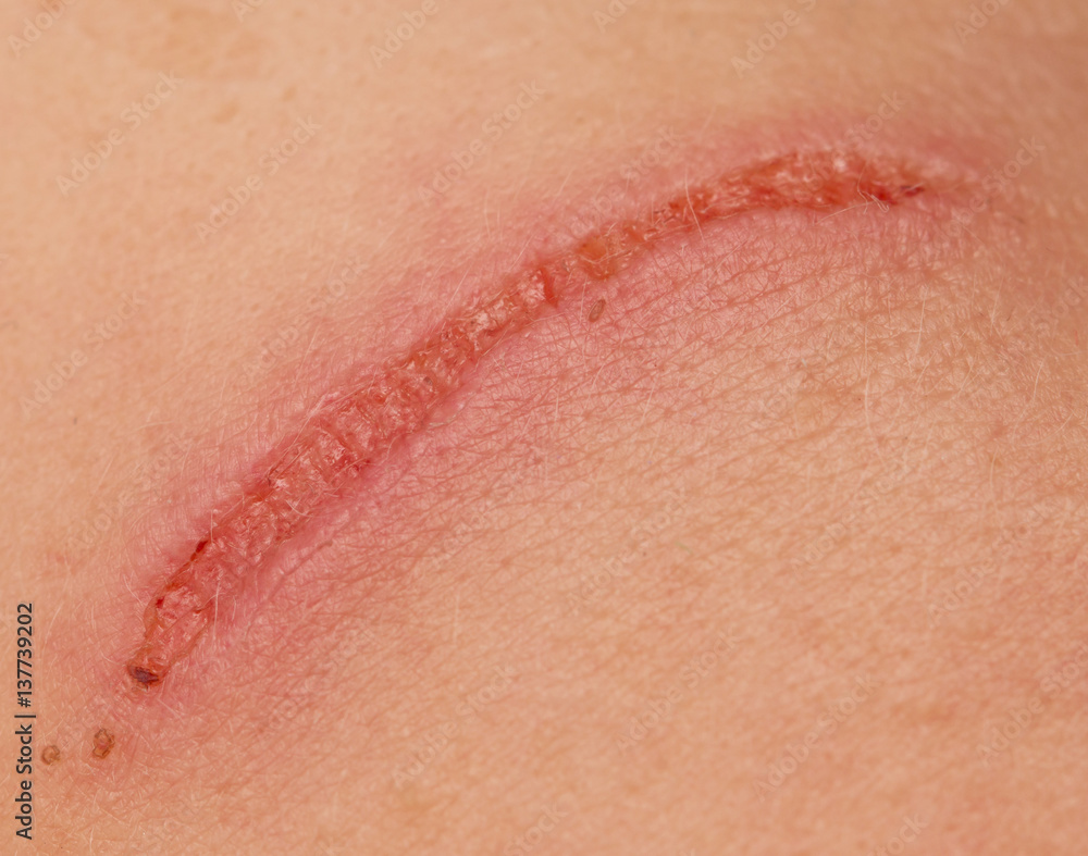 Fototapeta premium scratch on the face