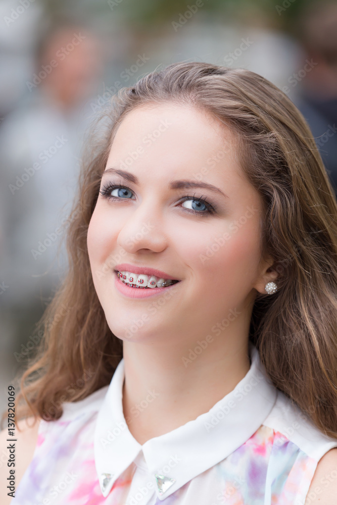 Close Up of natural beauty smiling teen face with braces Close Up of natural beauty smiling teen face with braces