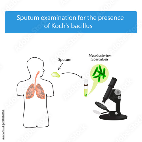 Sputum examination. World Tuberculosis Day. Infographics. Vector illustration on isolated background