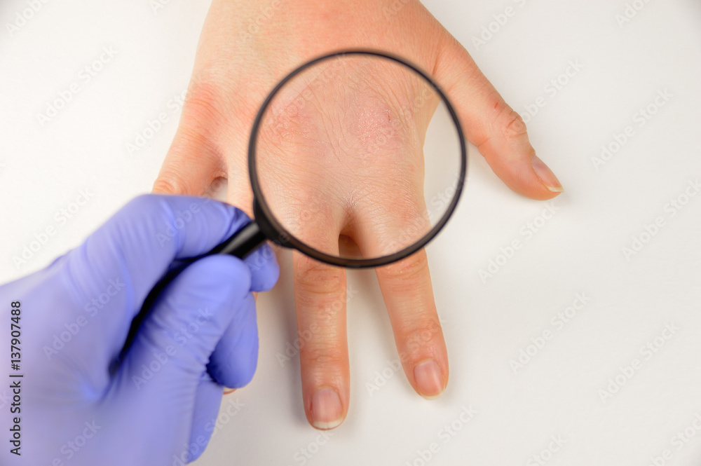 checking the hand checking the hand