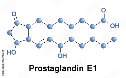 Prostaglandin E1, also known as alprostadil, is a prostaglandin which is used as a medication. In babies with congenital heart defects it is used by injection into a vein to open the ductus arteriosus photo