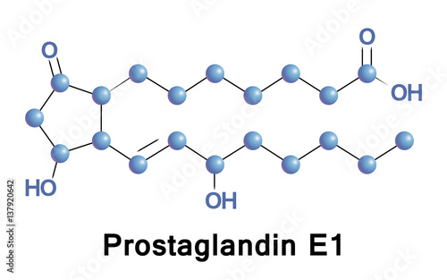 Prostaglandin E1, also known as alprostadil, is a prostaglandin which is used as a medication. In babies with congenital heart defects it is used by injection into a vein to open the ductus arteriosus