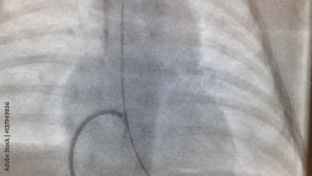 cardiac catheterization and great vessels cardiac catheterization and great vessels