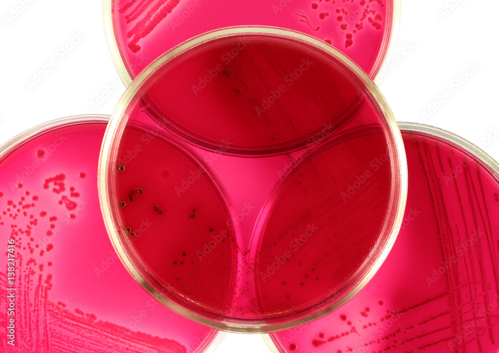 Petri plates microbiological installation. Four petri dishes loaded