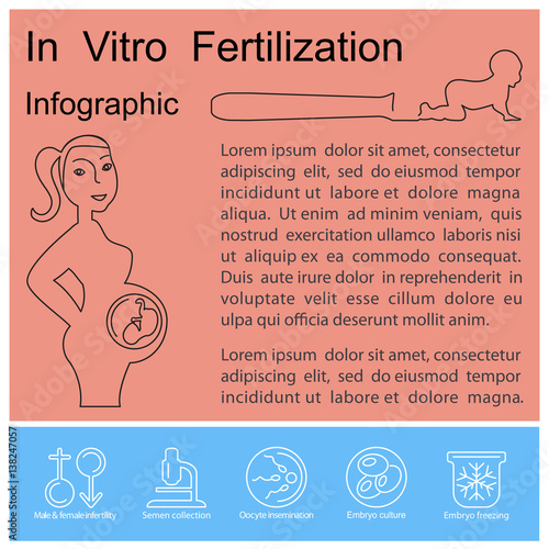 In vitro fertilization infographic. Illustration showing egg retrieval procedure, fertilization in laboratory, fertilized egg development and embryos transfer back to the uterus. Vector eps 10 