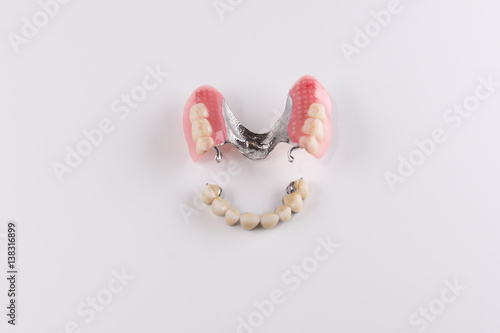 Clasp prosthesis with attachments fixing ceramic crowns