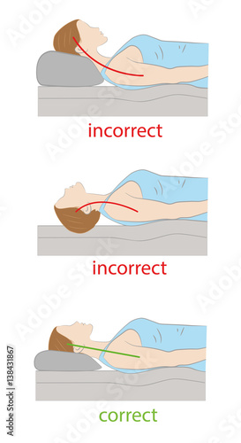 correct and incorrect position of the head on the pillow. medical recommendations proper sleep. vector illustration.